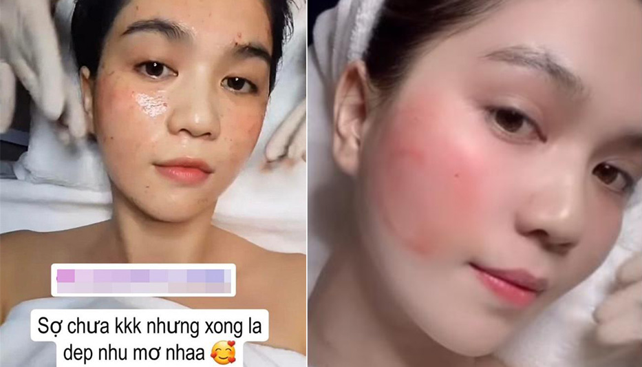 Ngọc Trinh khoe mặt châm chích lấm chấm đỏ, còn quảng cáo "đẹp như mơ": Chuyện gì đang xảy ra?