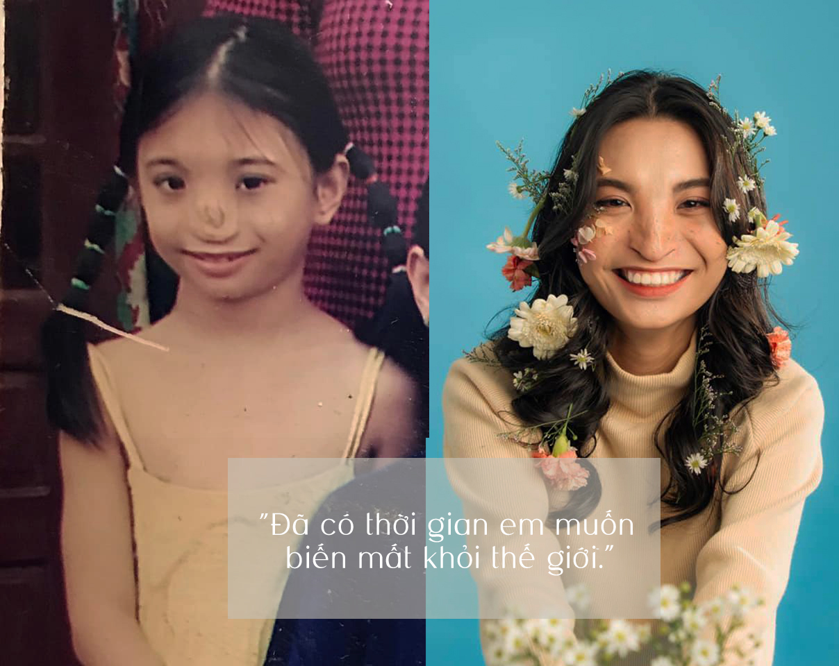 Phạm Thị Mỹ Duyên - 10X có chiếc mũi không xương bị mẹ của bạn học đến tận nhà chê 