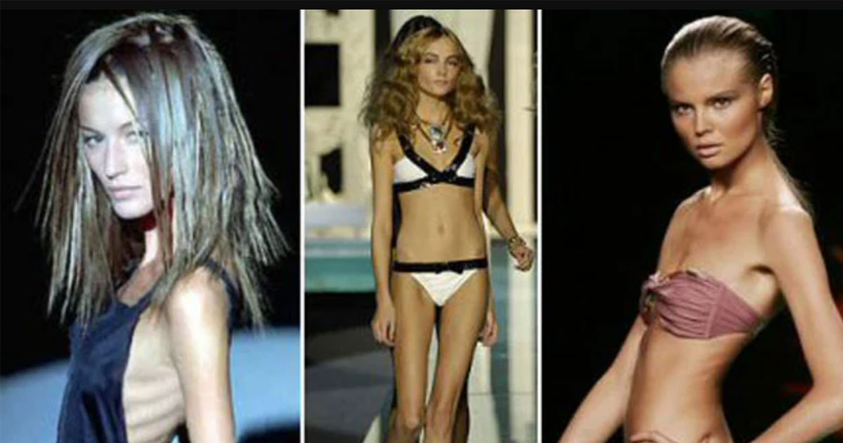 Cơn ác mộng người mẫu "Size 0": Người mẫu nhịn ăn, "Bạch Cốt Tinh" hiện hình trên sàn diễn