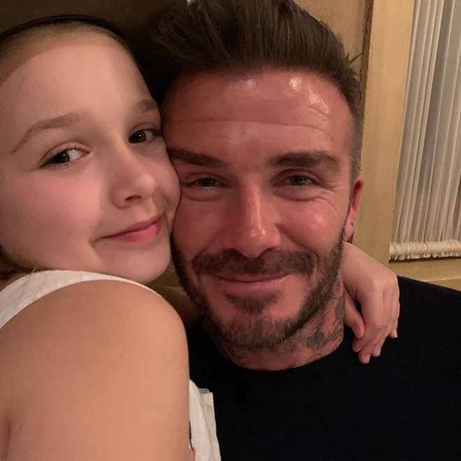 David Beckham đi căng da mặt để giữ vẻ ngoài phong độ tuổi 47 - Ảnh 6