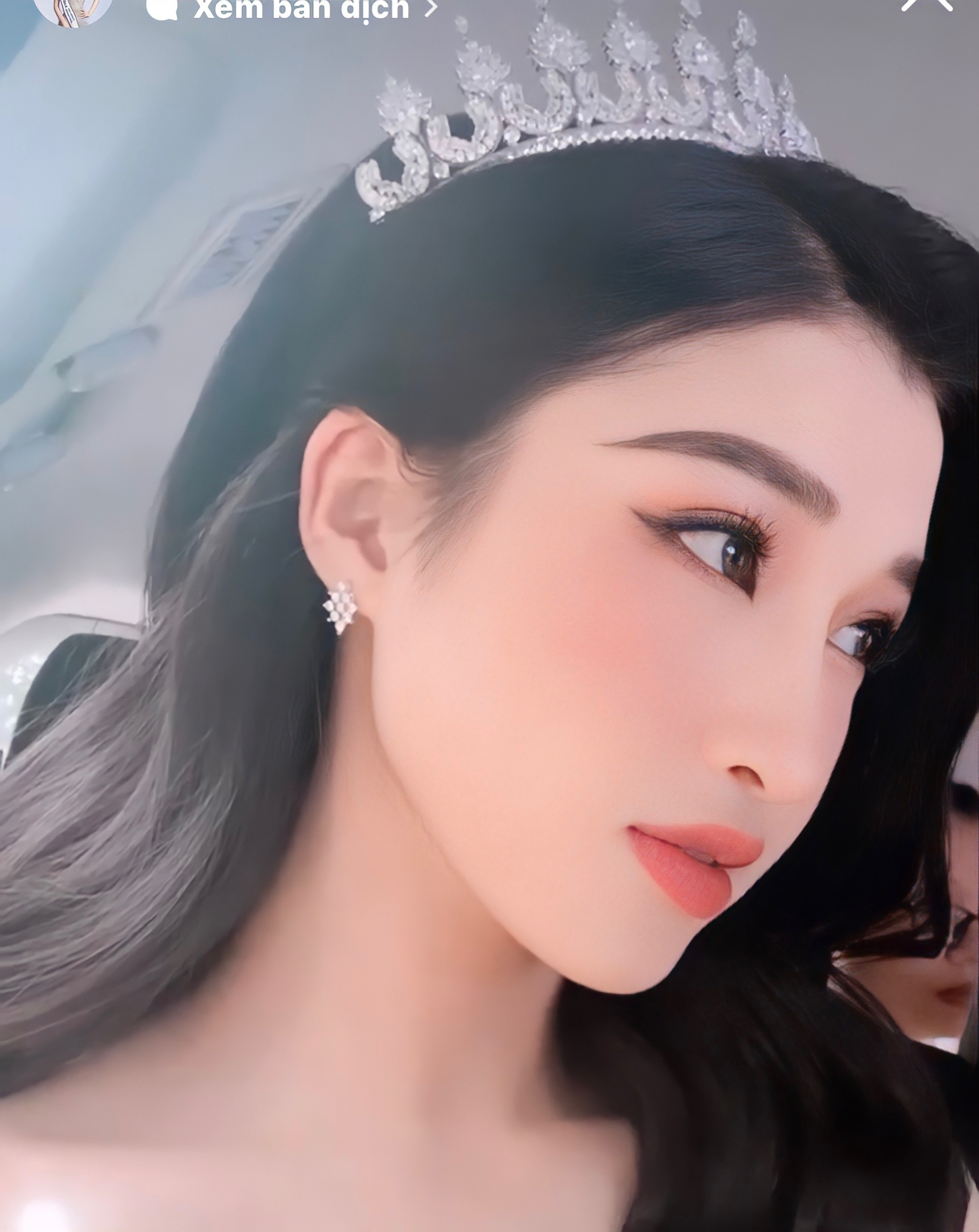 Mệnh danh Á hậu có làn da đẹp nhất Miss World 2022, Phương Nhi từng tự ti vì vết chàm trên trên mặt - Ảnh 5