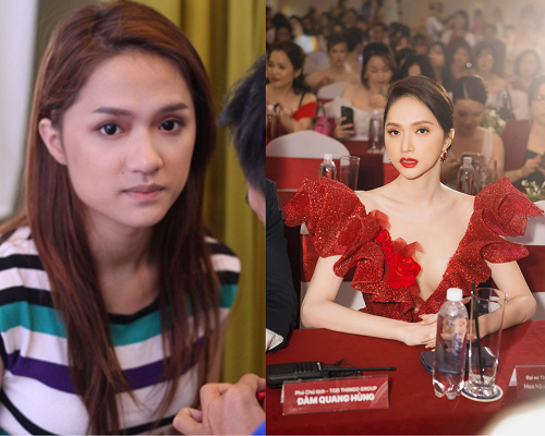 Hương Giang:"Em có độn một số bộ phận nhưng trên mặt thì không có nha anh!"