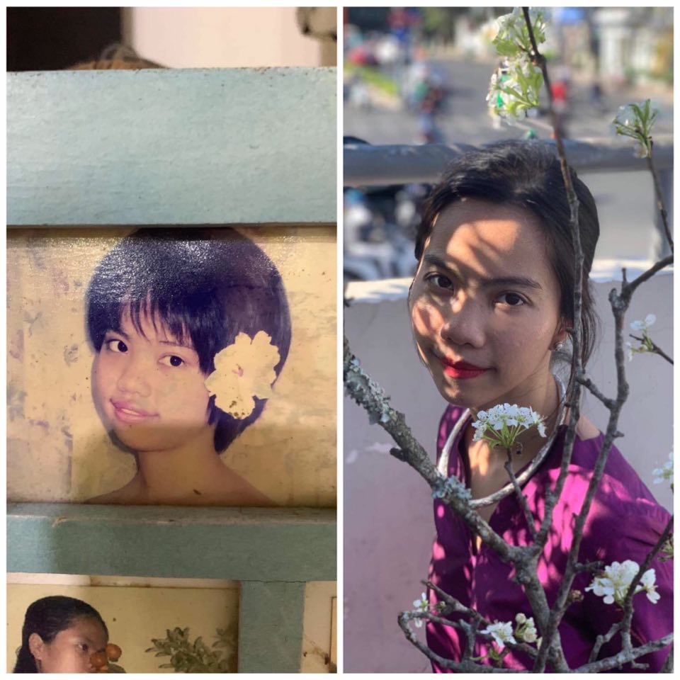 Trải nghiệm chỉnh nha, sửa răng của cô gái từng bị bạn bè gọi là "vịt Donald" vì sở hữu hàm răng hô