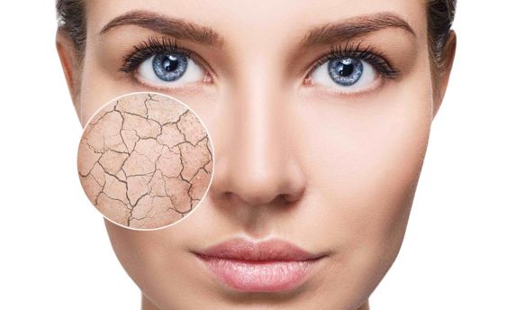 Cách chăm sóc da khô thiếu nước giúp cấp ẩm nhanh và hiệu quả nhất cho da