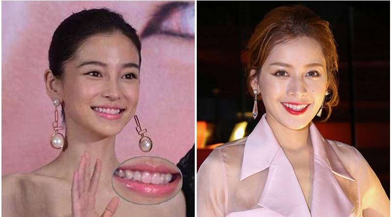 Lỗi trang điểm phổ biến tới nỗi từ Anglela Baby, Phạm Băng Băng đến Chi Pu ai ai cũng mắc