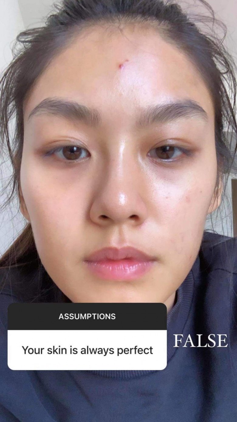 Đọ ảnh mặt mộc Top 3 HHHV Việt Nam 2022: Thủy Tiên từng chi chít mụn - Ảnh 6