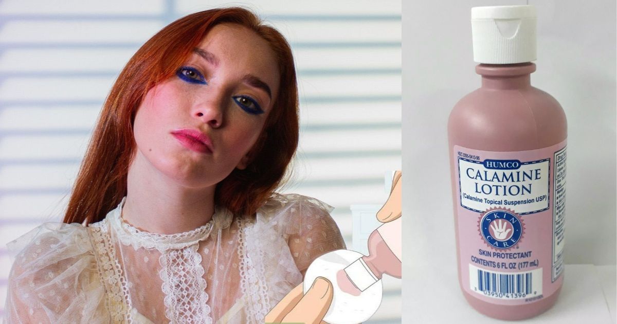 Mối nguy hại khủng khiếp từ kem dưỡng da chứa calamine 