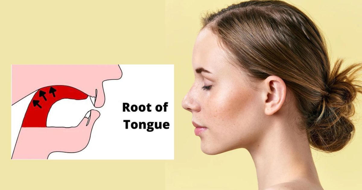 Điều kỳ diệu của phương pháp Mewing: Đẩy lưỡi lên vòm họng cũng có thể thu gọn khuôn hàm?