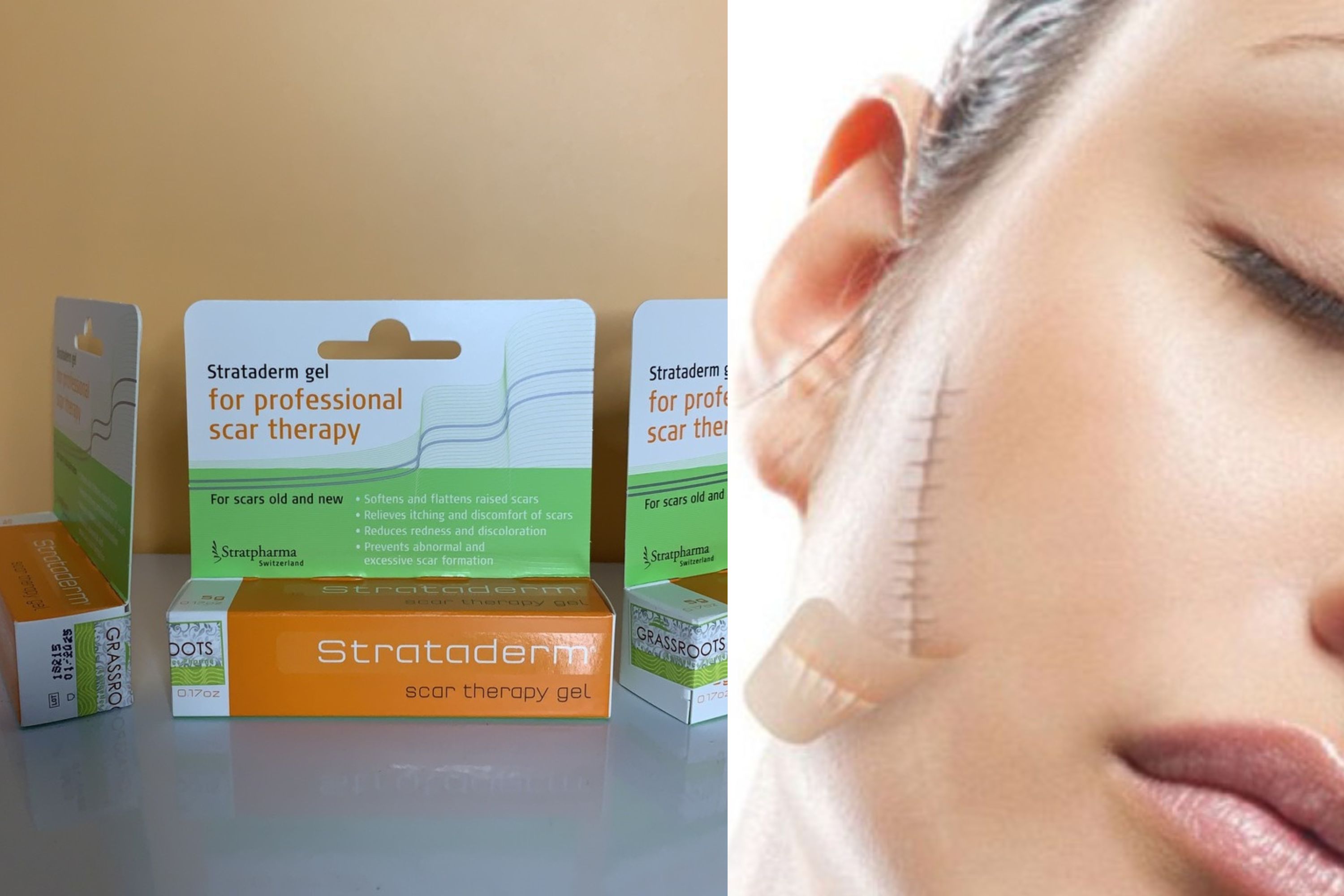 Kem trị sẹo Strataderm của Đức có tốt thật không?