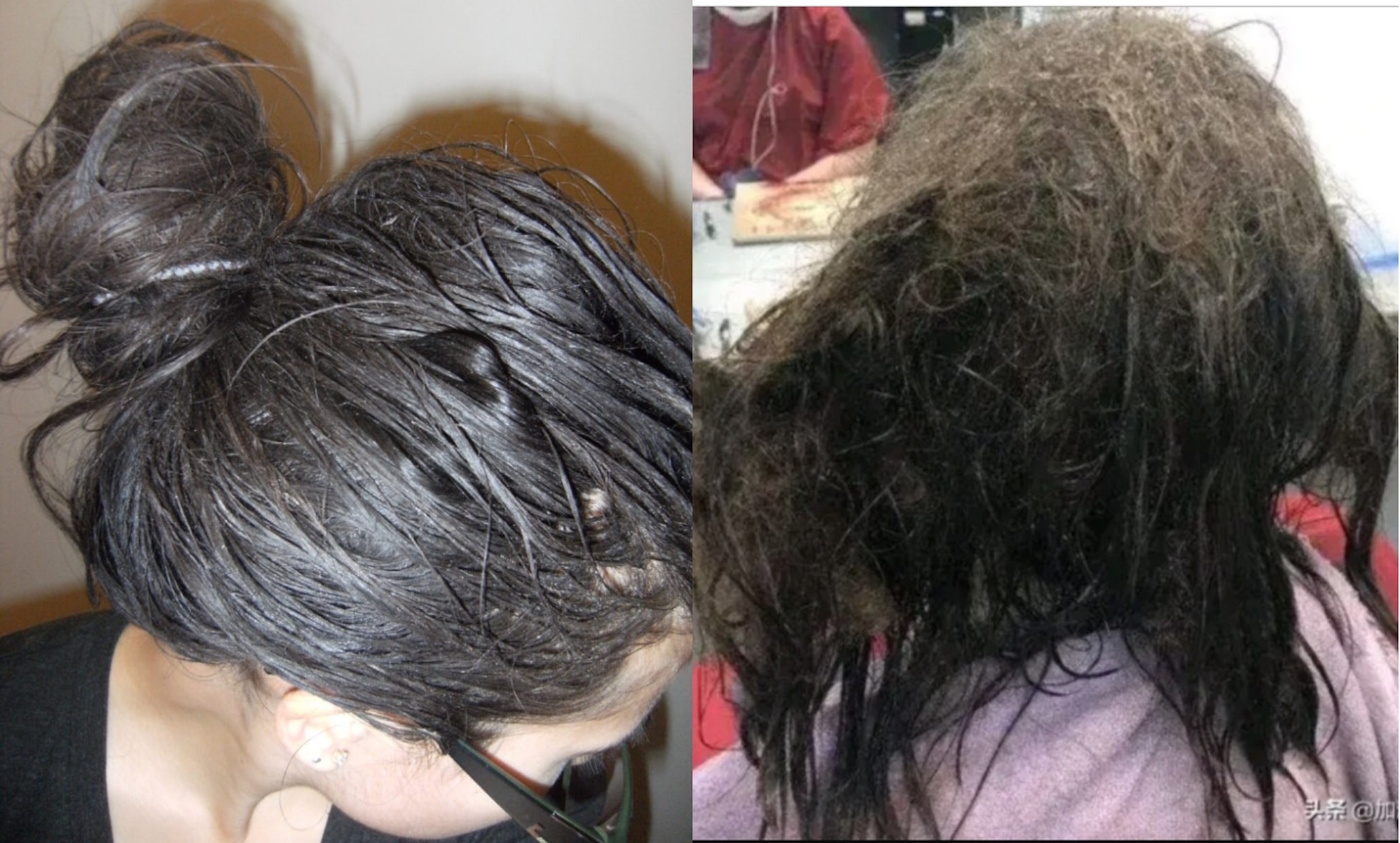 Sợ hói đầu, 1 cô gái nhịn gội trong 3 tháng, kết quả mất 11 triệu để gỡ rối