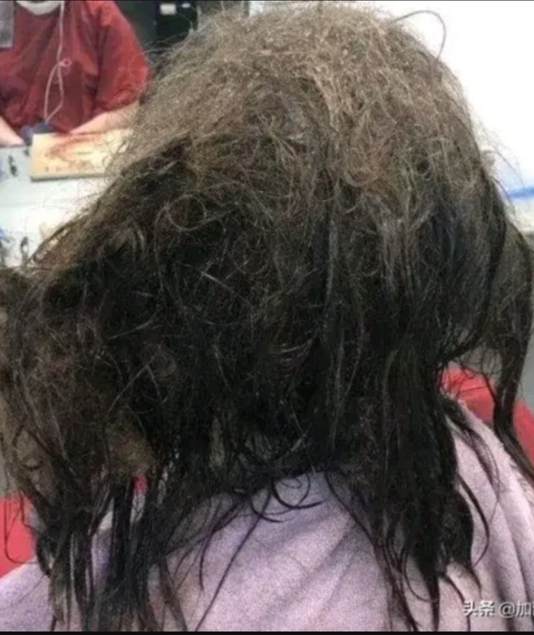Sợ hói đầu, một cô gái Trung Quốc không gội đầu trong 3 tháng, kết quả mất đến 3000 tệ để “gỡ rối” - Ảnh 2