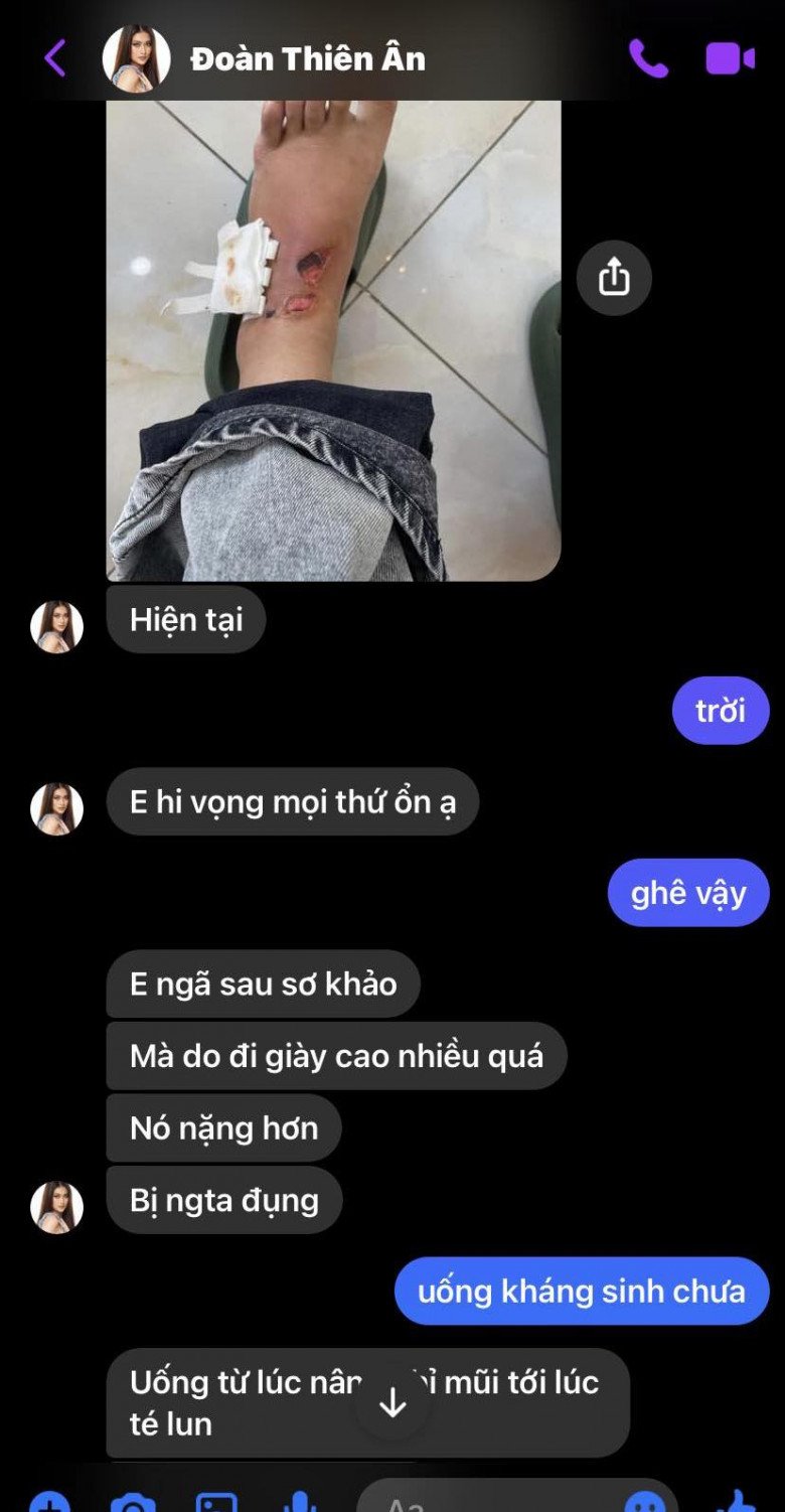 Hoa hậu Đoàn Thiên Ân khiến khán giả xót xa khi để lộ đôi chân bị thương bầm dập vì catwalk - Ảnh 2