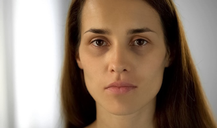 Nguyên nhân khiến mắt trũng sâu, mệt mỏi, thiếu sức sống