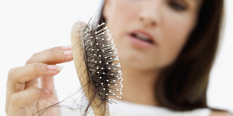 Nổi mụn da dầu có thể dẫn đến rụng tóc.