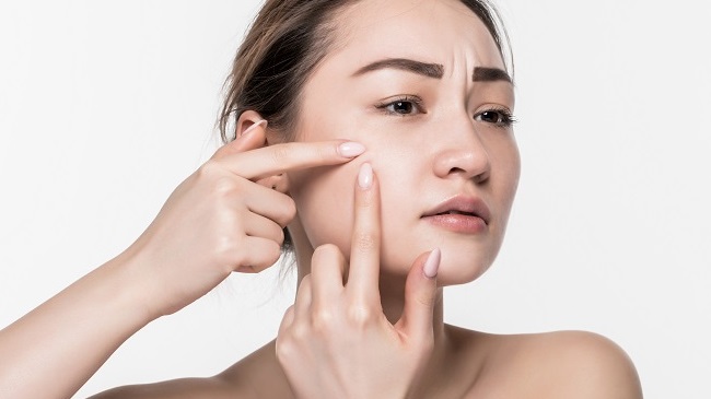 Mụn đầu trắng: Nguyên nhân và các biện pháp phòng ngừa