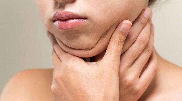 Làm sao để thoát khỏi cơn ác mộng mang tên "nọng cằm"?