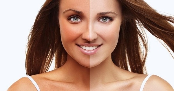 Các biện pháp khắc phục tại nhà để thoát khỏi tình trạng rám nắng