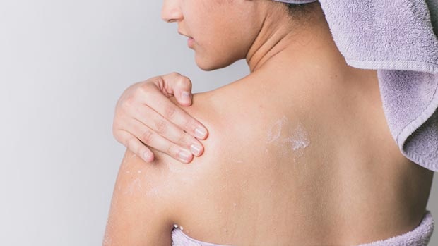 Cách trị mụn lưng là dùng kem dưỡng ẩm phù hợp cho da.