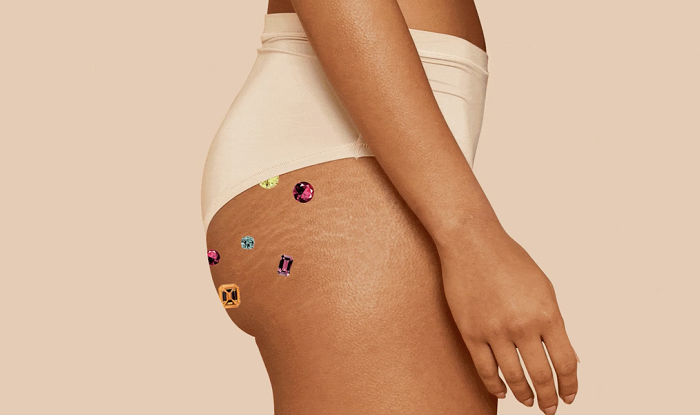 Cách trị mụn mông hiệu quả, an toàn từ chuyên gia