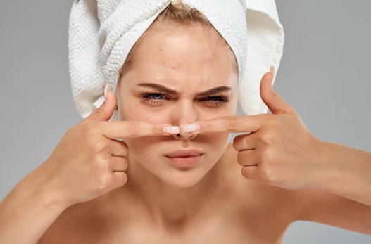 Mụn mũi thật khó chịu và đây là cách trị mụn trên mũi
