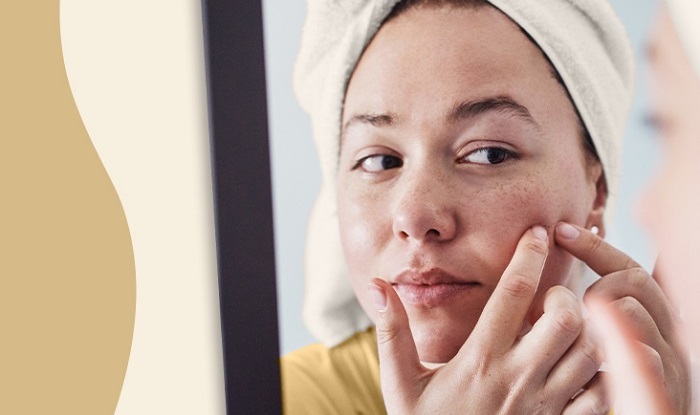 Bạn đã biết những cách trị mụn dứt điểm này hay chưa?