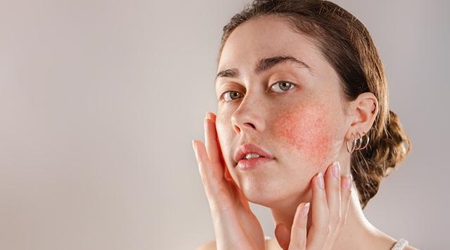 [Review]Top 20 Kem dưỡng ẩm cho da nhạy cảm tốt nhất hiện nay