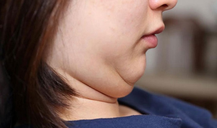 Bạn nên ăn gì để giảm mỡ mặt hiệu quả?