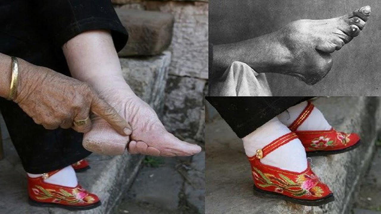 Tới năm 1960, tục bóc chân mới chính thức bị xóa bỏ hoàn toàn tại Trung Quốc