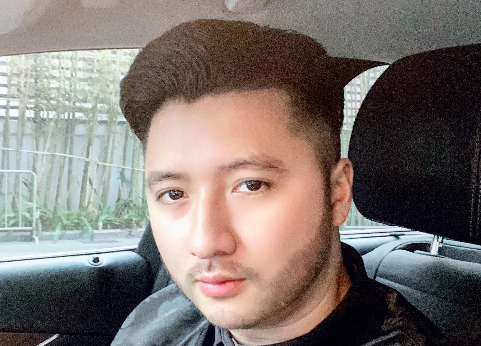 Những điều bạn cần biết trước khi muốn đi cấy râu như Trọng Hưng