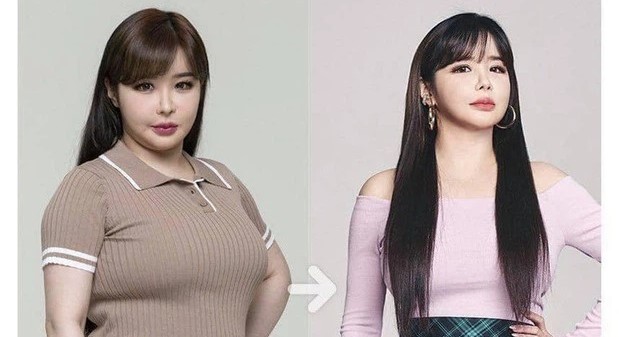 Park Bom giảm 11 kg bằng một chế độ ăn kiêng không thể 
