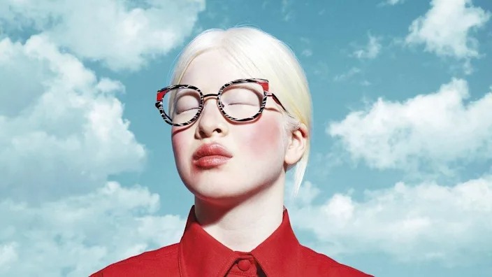 Hành trình phi thường của cô gái bạch tạng mồ côi đến người mẫu Vogue 