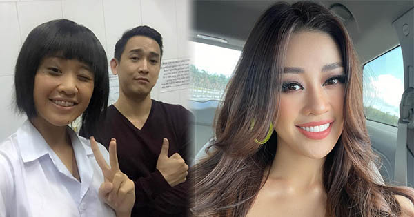 Khán giả phát hiện Khánh Vân đã từng "trùng tu" một chi tiết trên gương mặt