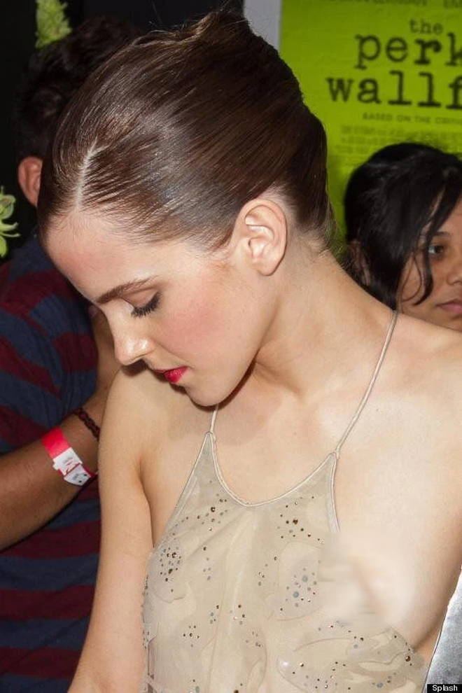 Emma bị lộ miếng dán ngực trước truyền thông.