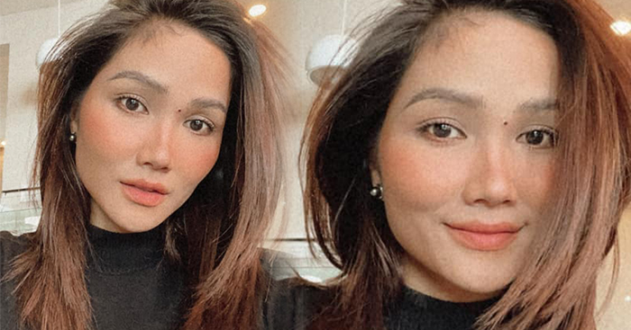 Cưng xỉu trước nốt ruồi "pha-ke" H’Hen Niê tự tay bôi lên mặt để... trị mụn