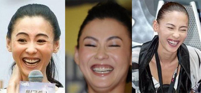 Đây là hình ảnh của Trương Bá Chi ngày mới vào nghề. Rất may là sau đó nữ diễn viên đã quyết định tẩy trăng răng và cắt lợi. Điều này giúp cho người đẹp thăng hạng nhan sắc vượt bậc.