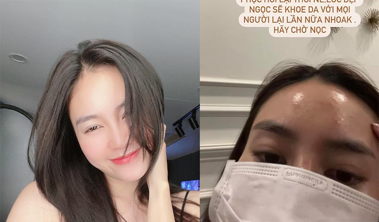 Ninh Dương Lan Ngọc thức khuya và cái "kết đắng" dành cho làn da