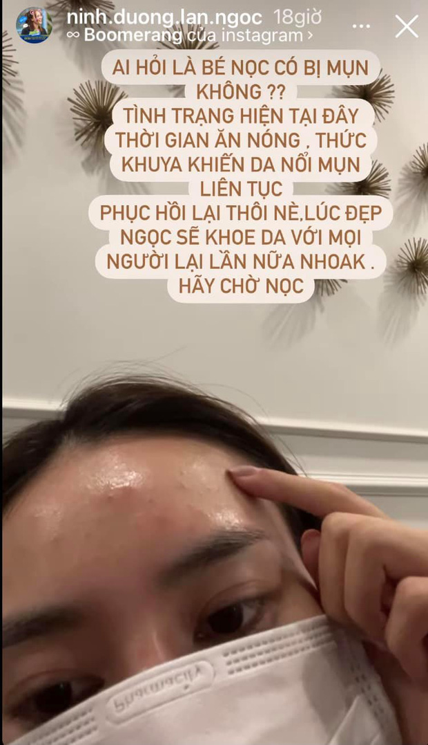 Ninh Dương Lan Ngọc đã phải than trời trên Instagram cá nhân khi làn da của cô nổi mụn chi chít. Đây là hậu quả của việc nữ diễn viên ngủ quá muộn, ăn uống không khoa học.