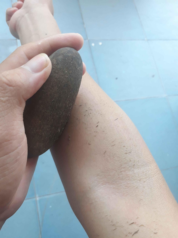 Một cô gái đã dùng một viên đá nhặt ở ngoài suối để tẩy da chết khi tắm.
