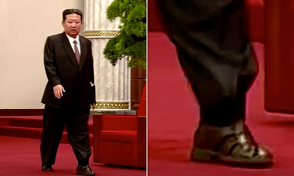 Ông Kim Jong Un xuất hiện trong sự kiện kỷ niện 76 năm thành lập Đảng Lao động Triều Tiên. Ông chọn cho mình một bộ suit, cravat nâu. Ở dưới ông đi sandals phối cùng với tất.