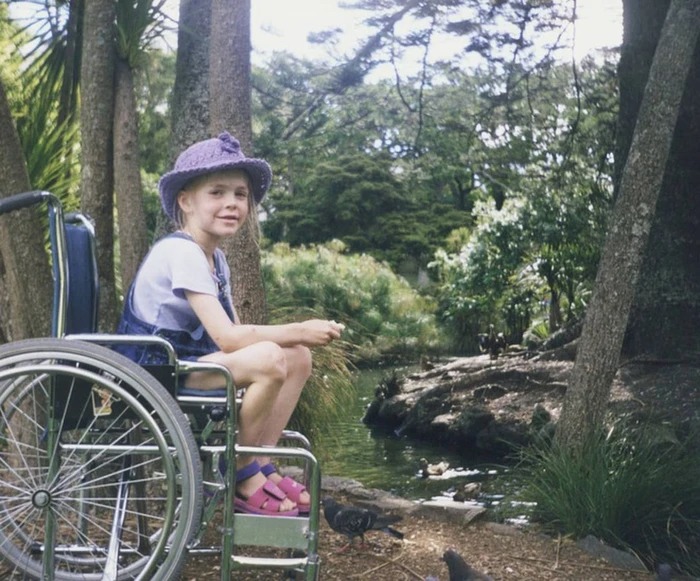 Năm 6 tuổi, Cherie đã phải tiến hành phẫu thuật cắt chân.
