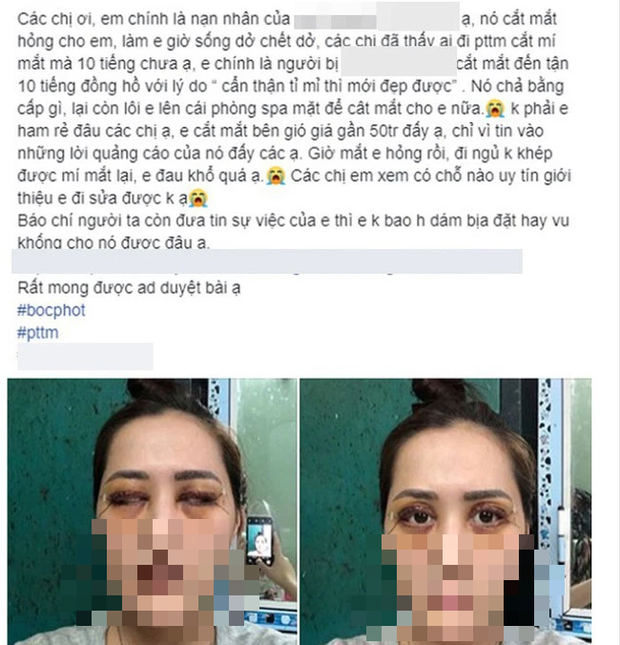 Một cô gái khác đã chi tới 50 triệu đồng để thực hiện phẫu thuật thẩm mỹ cắt mí. Đôi mắt của cô đầy sẹo và không thể khép lại.