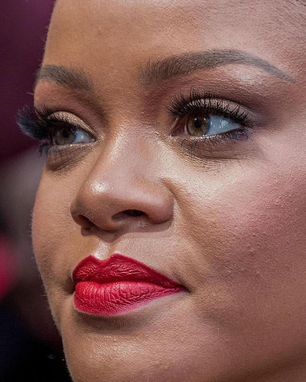 Anh hùng dân tộc Barbados kiêm 'nữ hoàng kem trộn' Rihanna có làn da bị chảy xệ rất nhiều, lỗ chân lông của cô cũng to và làn da có mụn ẩn.