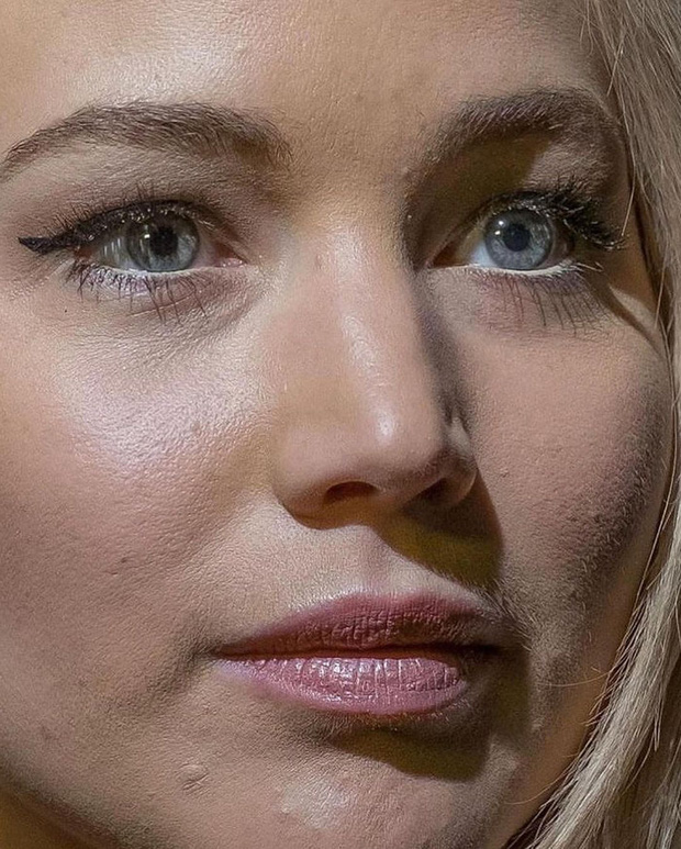 Bà bầu Jennifer Lawrence có khá nhiều mụn to trên gương mặt. Tuy nhiên, lỗ chân lông của người đẹp khá nhỏ.