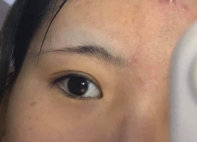 Những phương pháp làm đẹp chị em không nên thử tại nhà nếu không muốn mất Tết