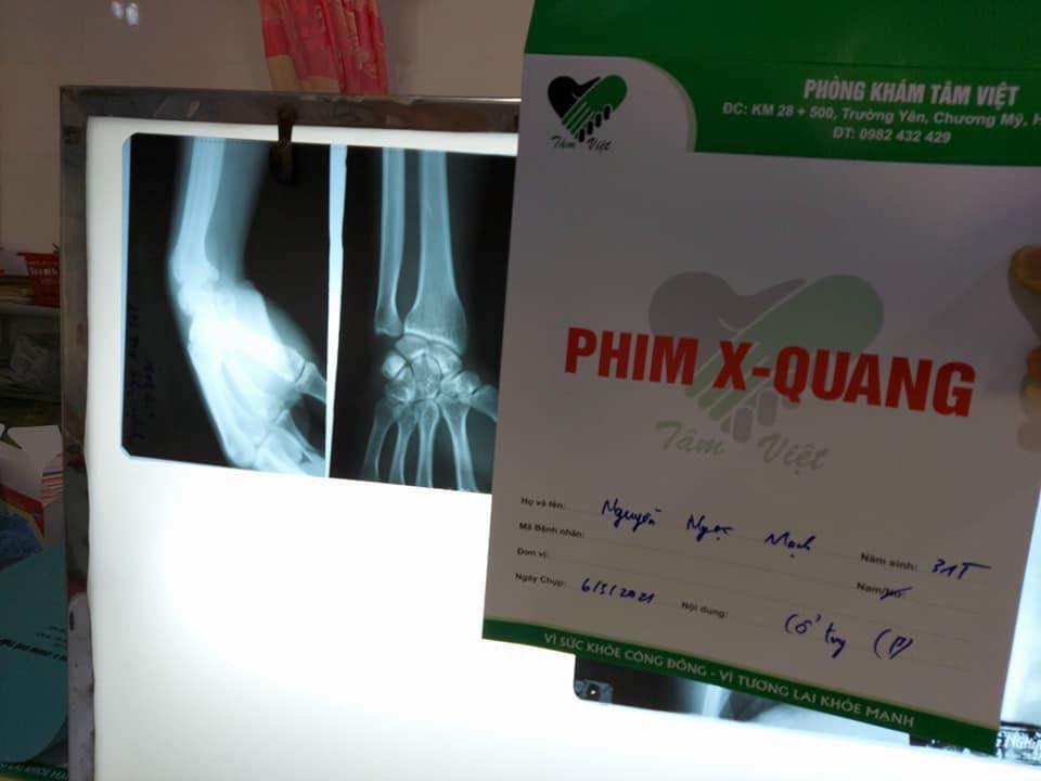 Hồ sơ và hình chụp X-quang tay phải của anh Mạnh