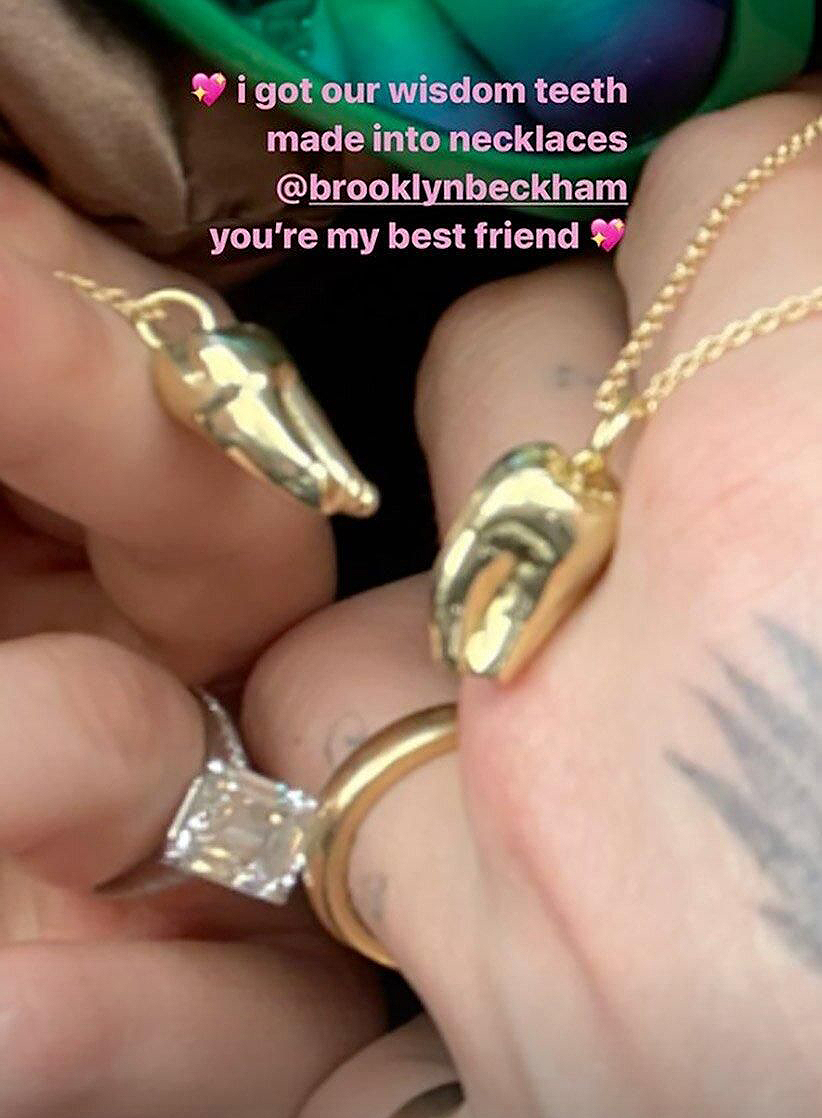 Cặp dây chuyền độc, lạ được Brooklyn đăng tải trên tài khoản Instagram trước đó