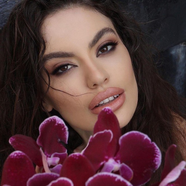 Ngay từ khi mới đăng quang, Tân Hoa hậu Hoàn vũ Albania đã trở thành đề tài bàn tán của cư dân mạng bởi nhan sắc của mình