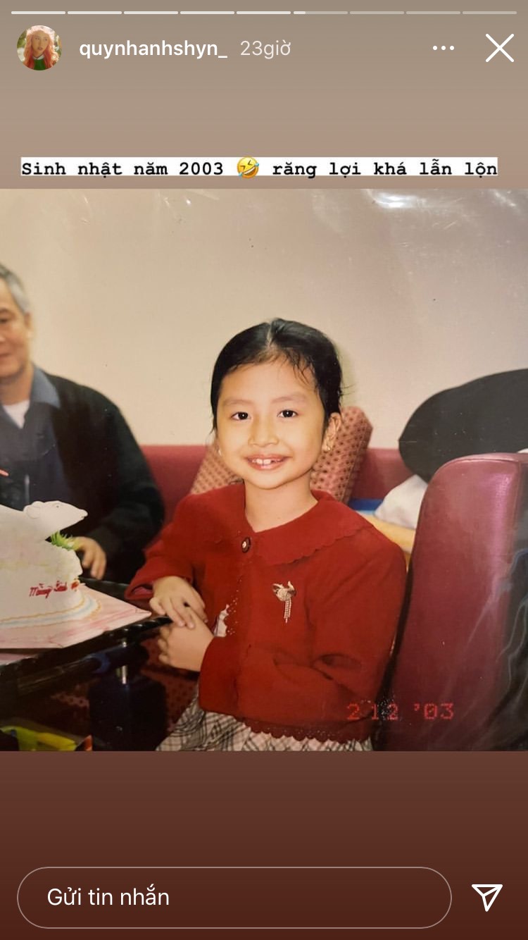 Thời điểm năm 2003, Quỳnh Anh Shyn sinh nhật 7 tuổi, cô sỡ hữu hàm răng khá 'lẫn lộn'.