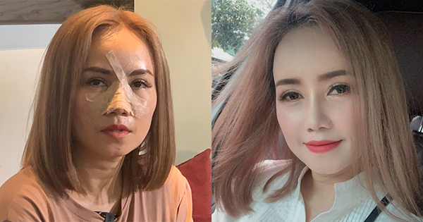 "Cô Xuyến" Hoàng Yến khoe diện mạo mới sau 2 tuần bị chồng cũ "đấm vỡ mũi"