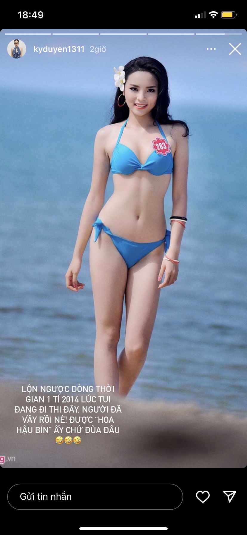 Hoa hậu Kỳ Duyên phải hồi nghi vấn rút xương sườn để có vòng eo siêu thực - Ảnh 2